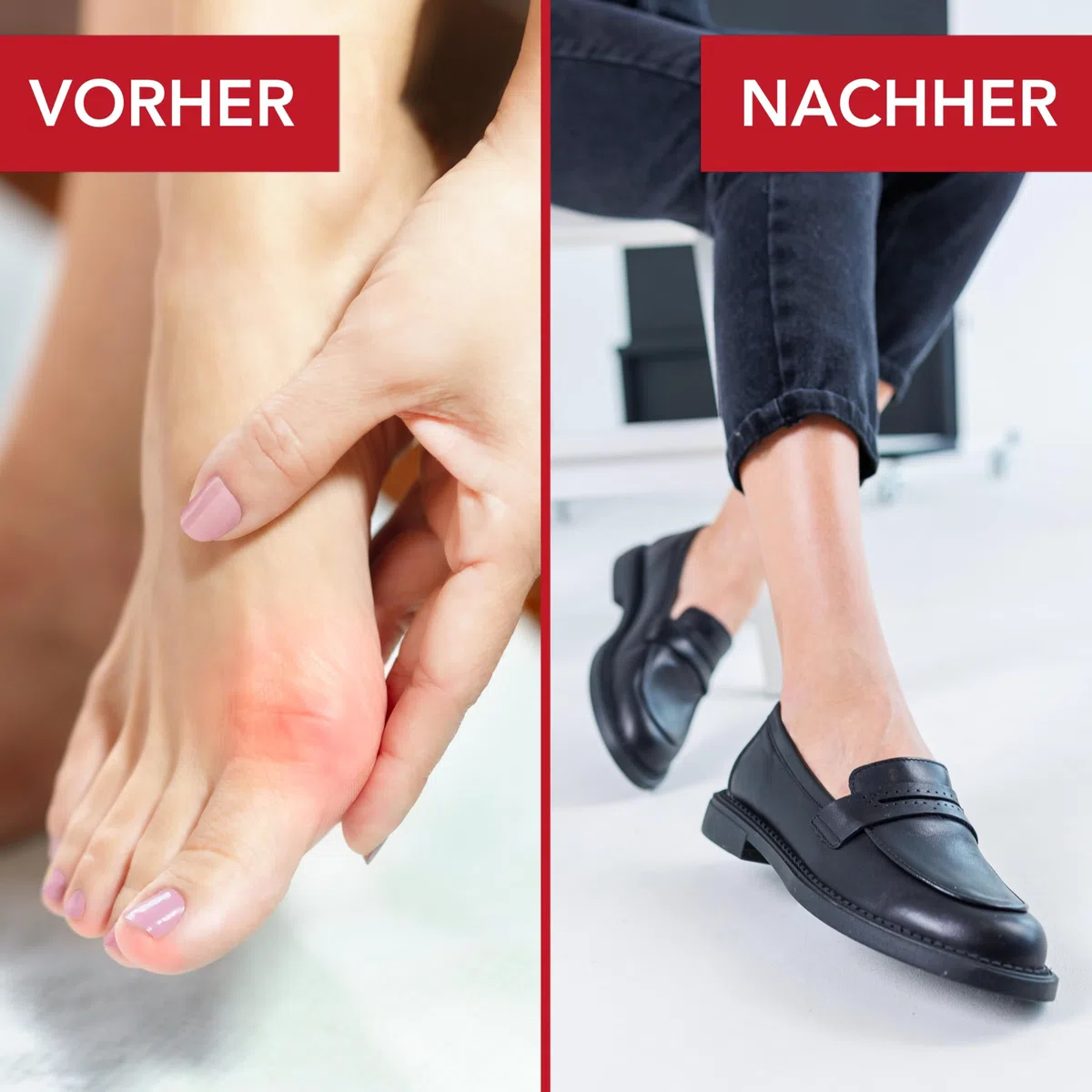 Schuhdehner Spray & Lederdehnungsspray Ecoline 150 ml Leather Shoe Stretcher, aerosolfrei ohne Treibgas-Dehnungsspray für enge Lederschuhe, leder weichmacher für schuhe, weitet sanft für guten
